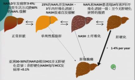 一文读懂非酒精性脂肪性肝病的防治