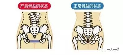 生完宝宝盆骨被撑开 脊柱变形 又难看又难受