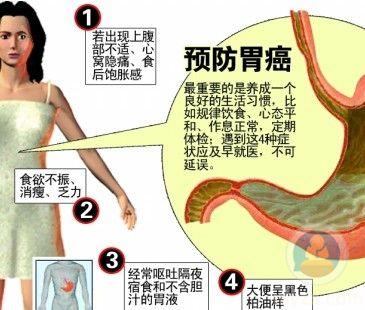 胃癌早期症状不明显,如何及时识别和治疗?