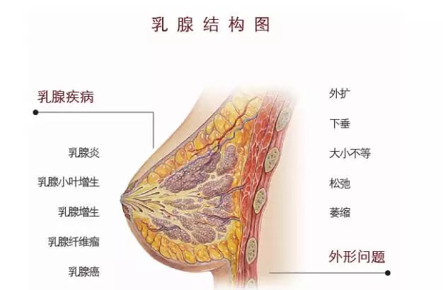 乳腺增生与乳腺癌有什么关系?