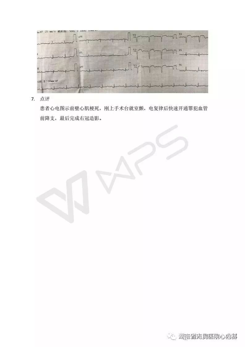 湖南省人民医院胸痛中心急性心梗病例2017年11月第二周