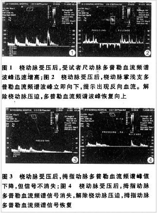 关于改良allen试验结果的判读,你需要了解这些.