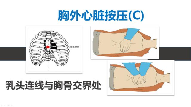 5至6厘米?按那么深,还不把胸骨按折喽?)