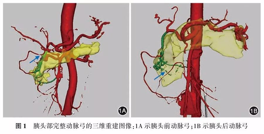 胰头癌三维可视化精准诊治专家共识