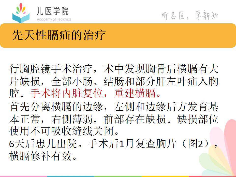 病例讨论第116期丨先天性膈疝