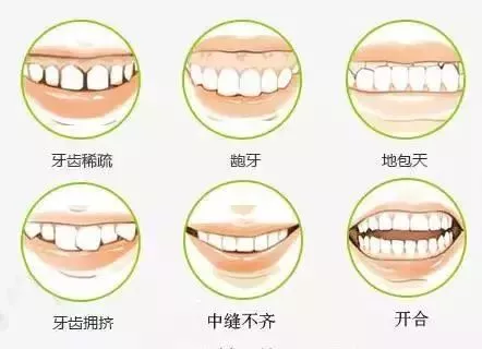 无论你是牙齿稀疏,牙齿前突 地包天,牙齿轻度至重度拥挤 门牙缝隙明显