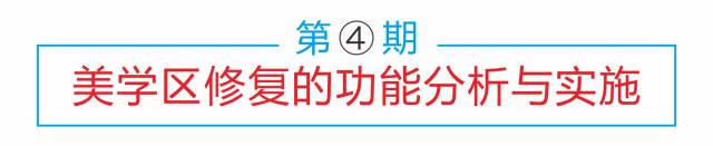 实操课 精确印模制取技术 单线及双线排龈技术 印模制取技术要点 cad