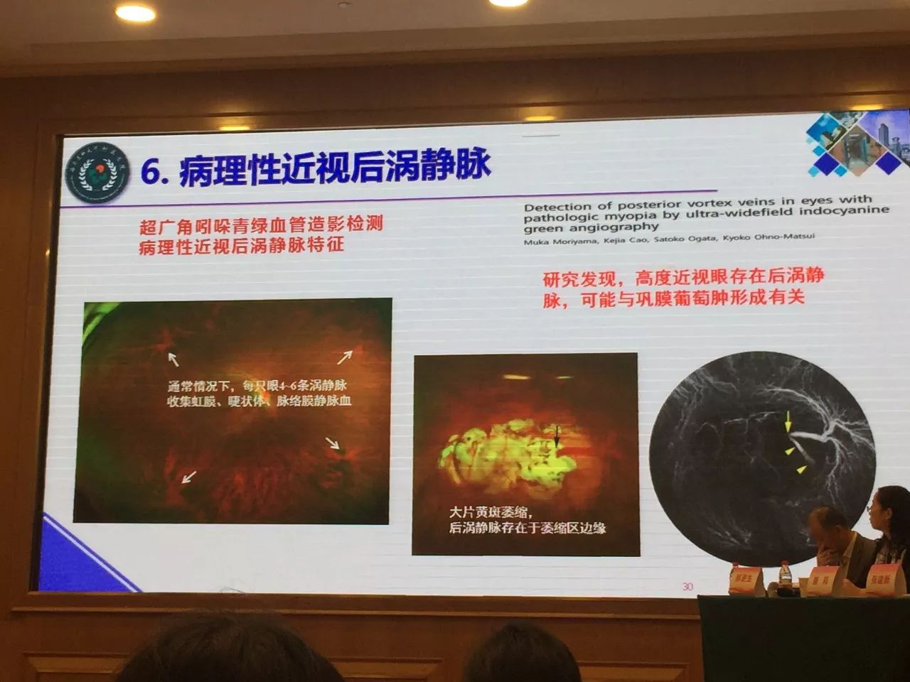 西南医科大学附属医院吕红彬教授病理性近视引起的8种眼底改变