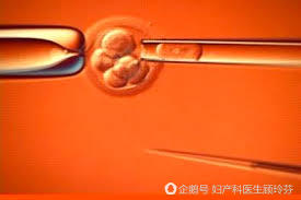 着床前筛查或诊断之一:移植有缺陷的胚胎