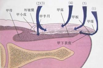 真菌感染导致指甲结构改变,颜色改变,并且相互传染的一种真菌性皮肤病