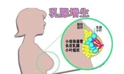 乳房出现"青筋" 是什么原因呢?