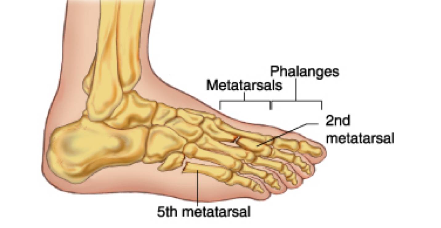 跖骨区(metatarsals)