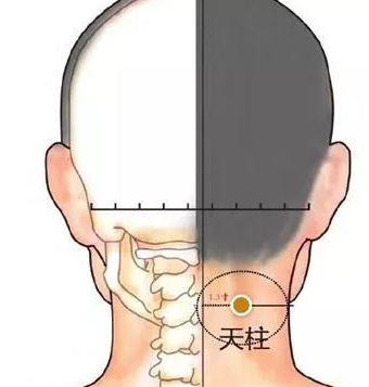 艾灸5个穴位—颈椎病说走就走