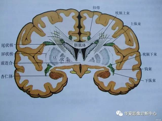 半卵圆中心与放射冠有什么区别