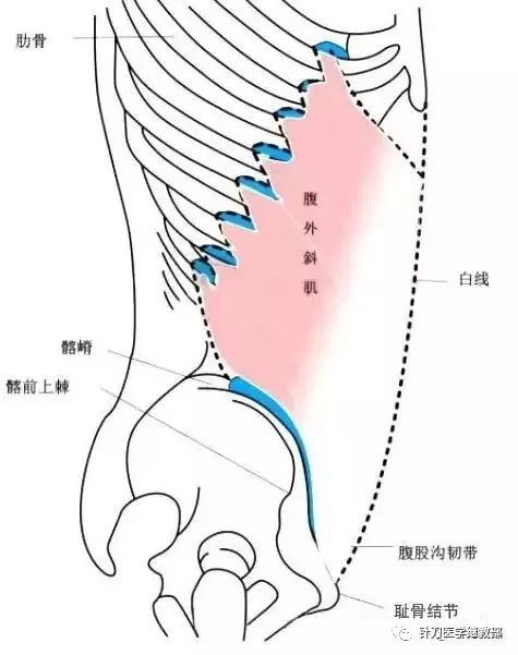 腹外斜肌损伤多在其止点髂嵴部.