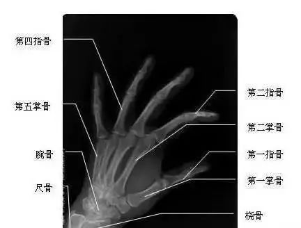 如果你也有这种感觉,恭喜你,和小编一样,应该是得了拇指狭窄性腱鞘炎!