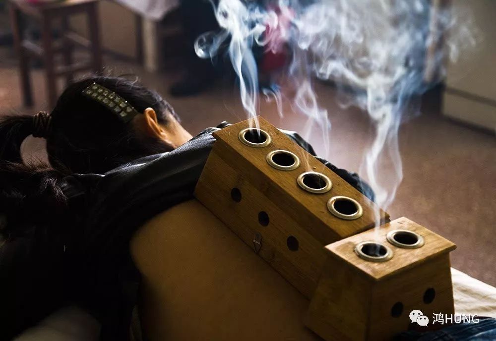 艾灸| 烟火里的中医文化,艾香中的阴阳传承