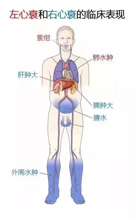 13.左心衰和右心衰的临床表现12.电解质紊乱的典型心电图表现11.