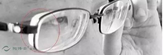 4000多度的近视眼镜 这厚度比酒瓶底还要厚 保护视力何其重要,千万不