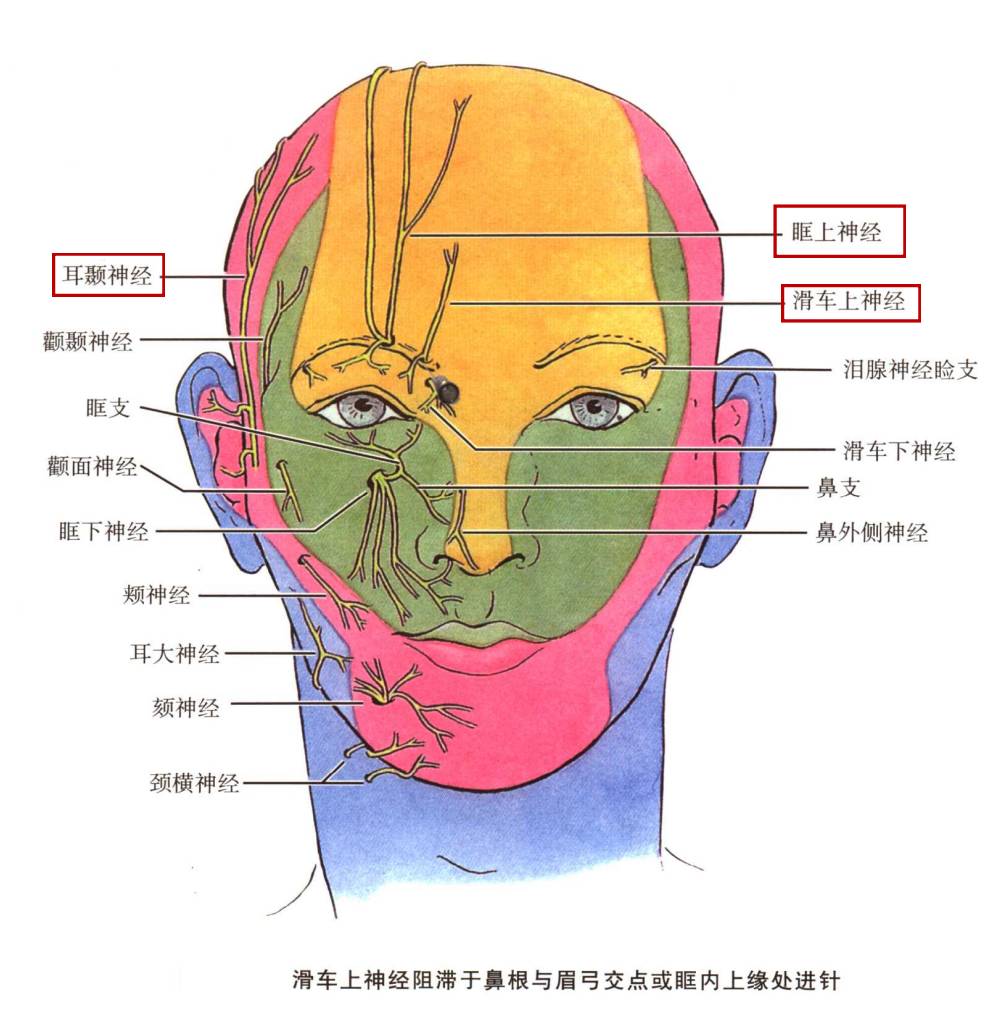 患者仰卧,头正中位,于眶上缘内1/3处至眉中间触及眶上切迹,进针方向