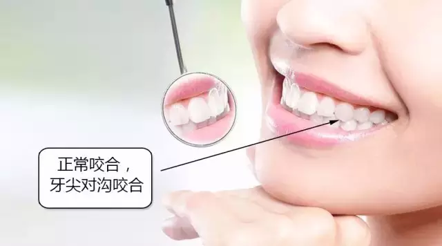 教你如何简单自测牙齿整齐程度