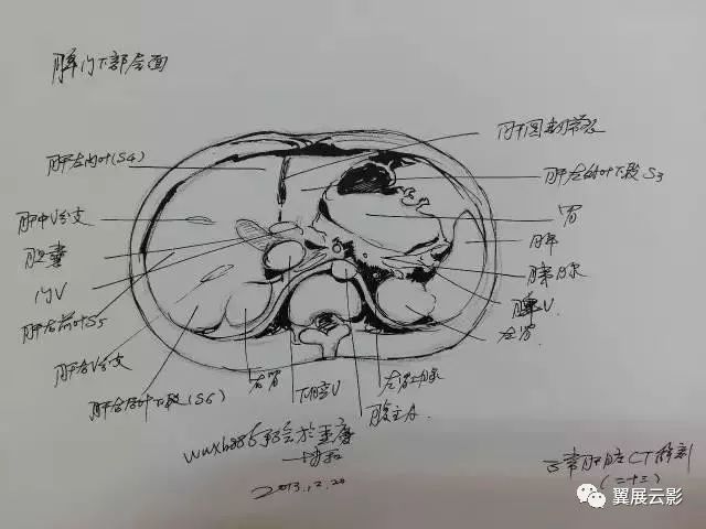 肝脏ct片怎么看