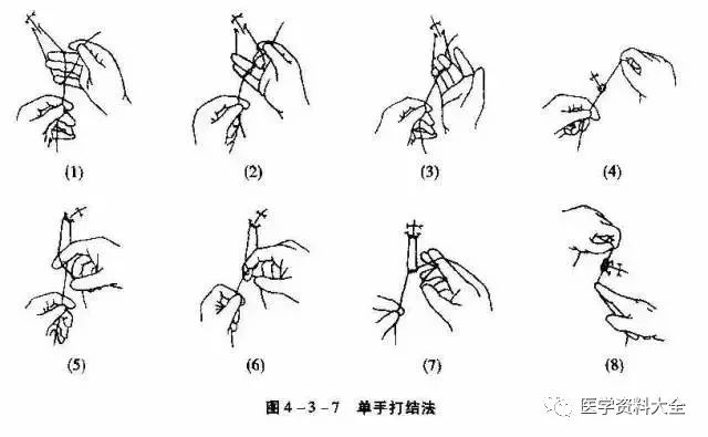 (2)双手打结法(two-hand technique):分别以左右手用相同的方法打成