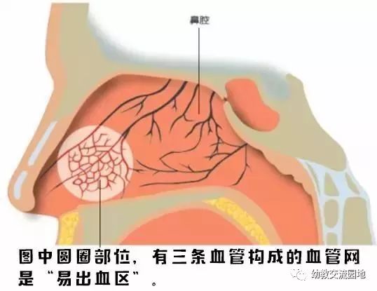 鼻出血的部位大多位于接近鼻孔的鼻中隔上,因该处鼻粘膜较薄