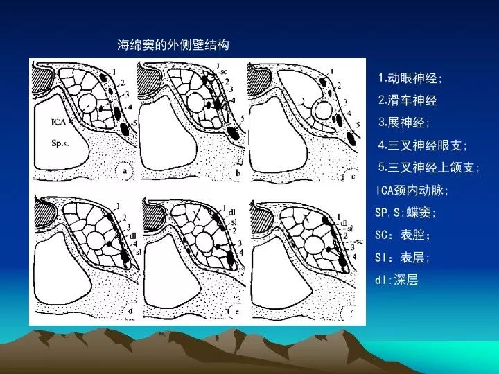 [学习资料]海绵窦的解剖