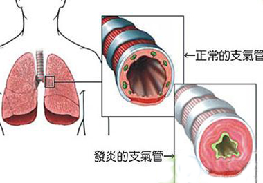 防止色素回流的是什么原理_色素痣是什么