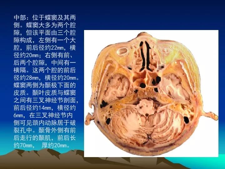 [学习资料]海绵窦的解剖