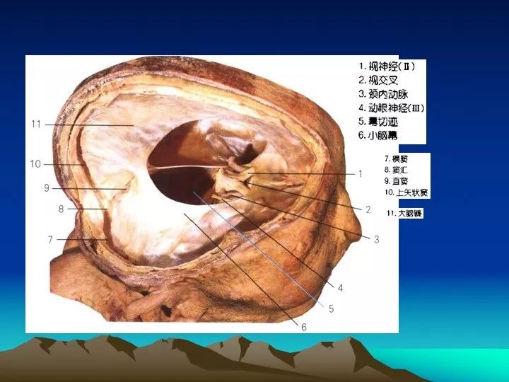 [学习资料]海绵窦的解剖