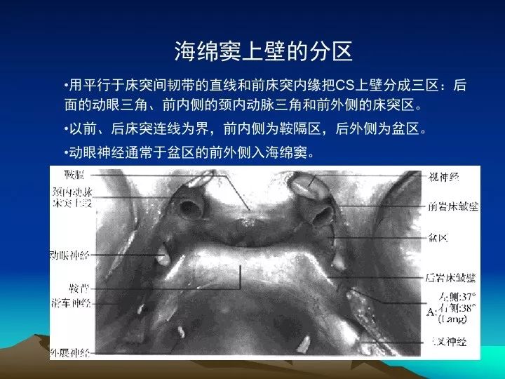 [学习资料]海绵窦的解剖