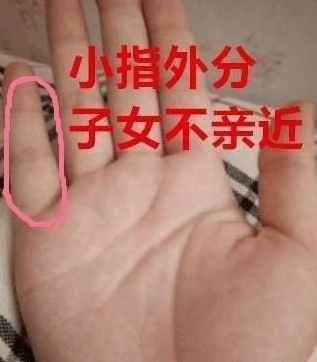 人口压力小指的是什么_小指过三关是什么意思(2)