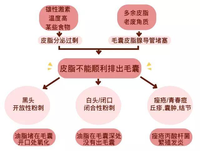 粉刺,闭合性粉刺,炎性痘痘,黑头,白头和脂栓都是什么样的?