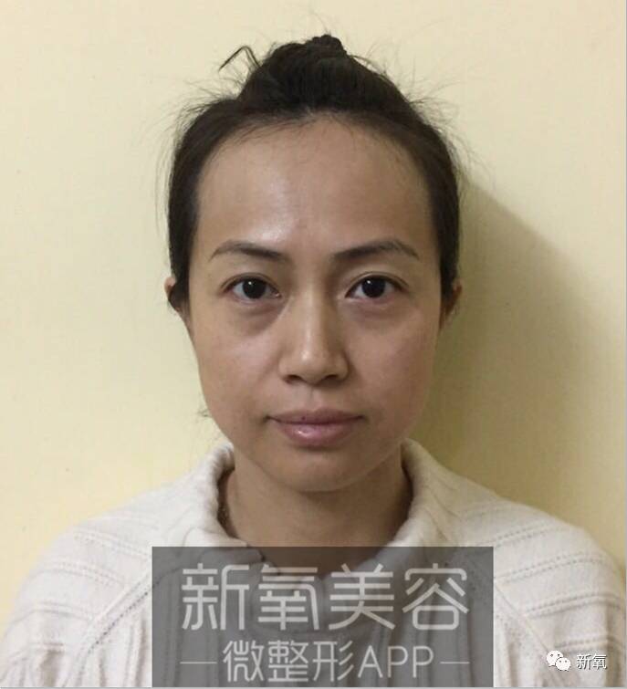 又一知名网红直播忘记开美颜,蒜头鼻,大饼脸··· 不