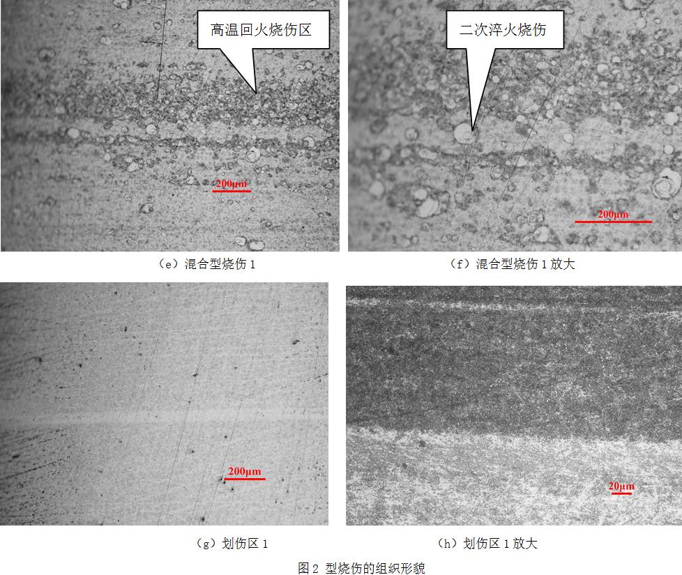 (1)二次淬火烧伤组织