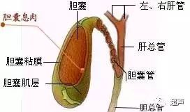 体检发现胆囊息肉肿么办?