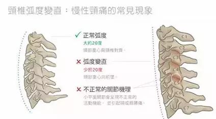 【图解中医】颈椎分七段,每段不好都会产生不同的疾病