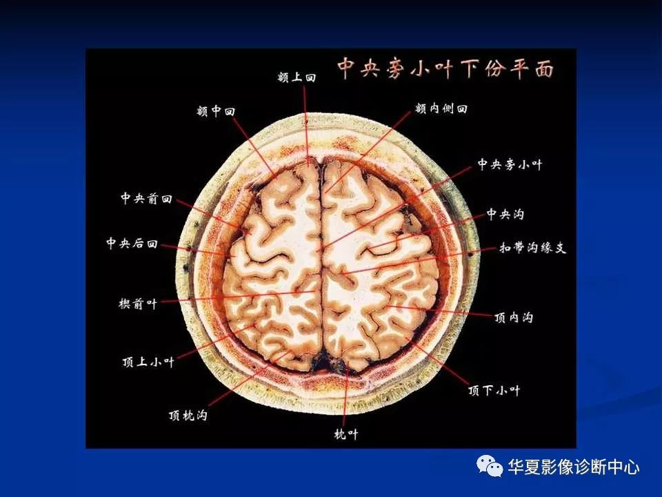 各部位详细标注的大脑断层解剖