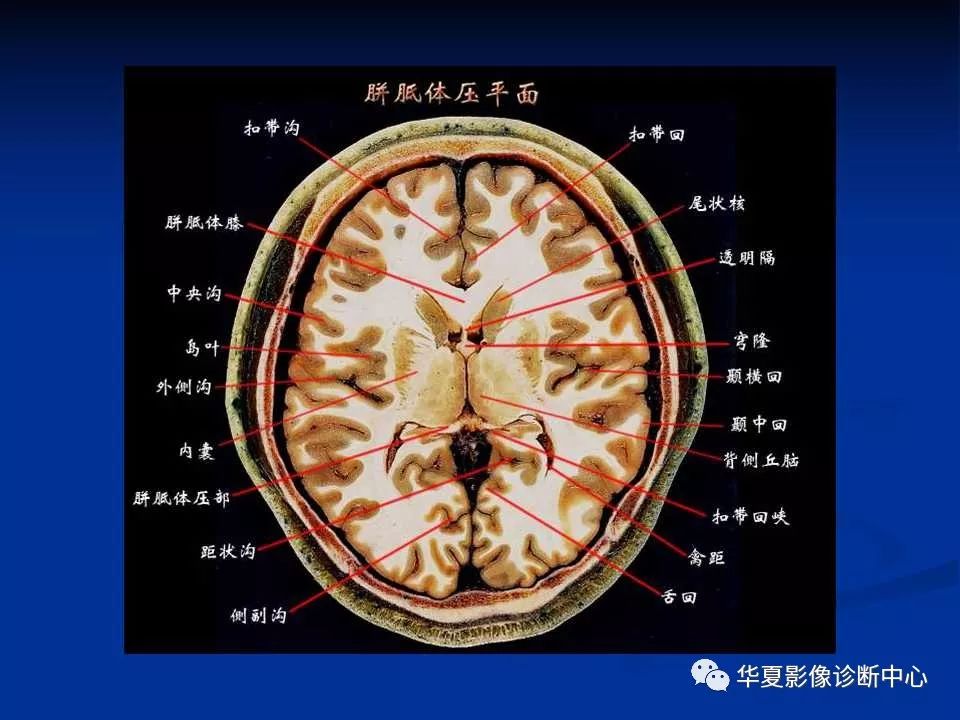 各部位详细标注的大脑断层解剖