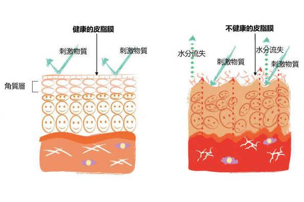 冬季皮肤缺水,但你补水都补对了吗?