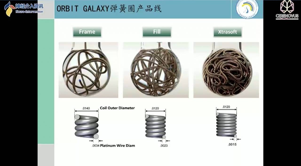 【强生医疗cnv-神经介入专栏】丨张庆荣教授:galaxy弹簧圈在小动脉瘤