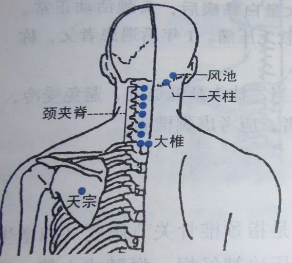 头昏,手麻,脖子痛,一扭头还发出响声?是颈椎病吗?