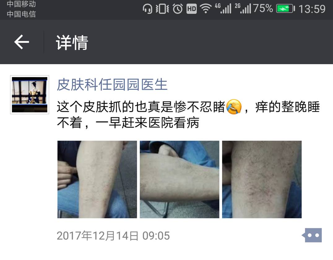 痒痒痒!皮肤科医生教您远离冬季皮肤瘙痒症!