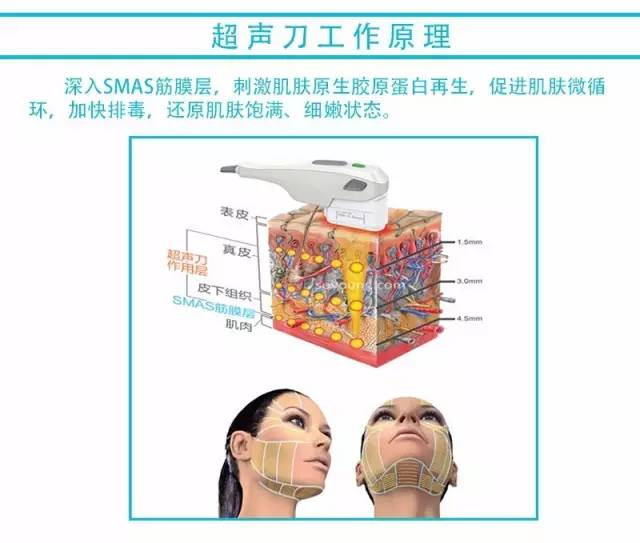 超声刀牵手水光针,抗衰完美助力!