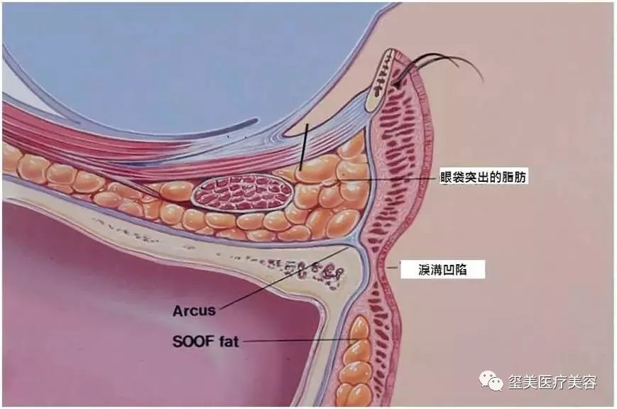 你知道催老纹泪沟在哪儿吗