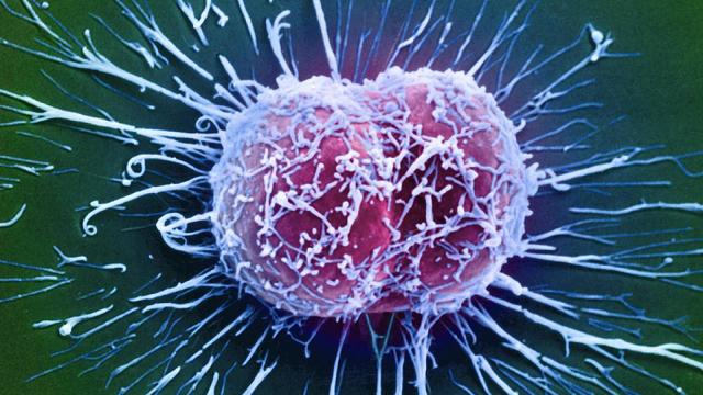 癌细胞能在高温中被杀死吗