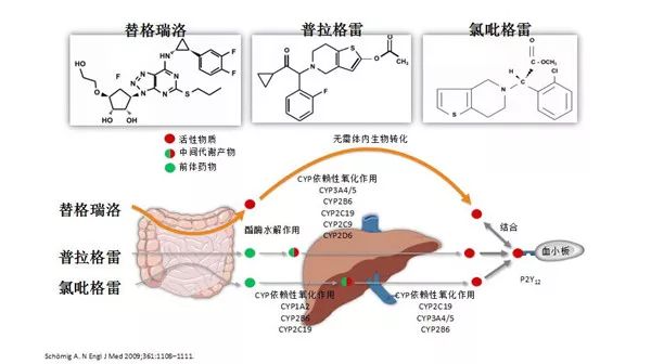 病例分享|邓佳:acs患者支架内再狭窄遭遇氯吡格雷抵抗