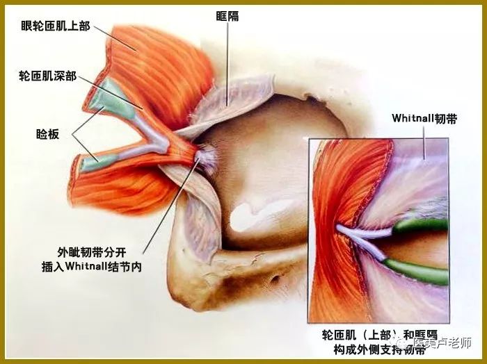 揭秘外眦开大的误区